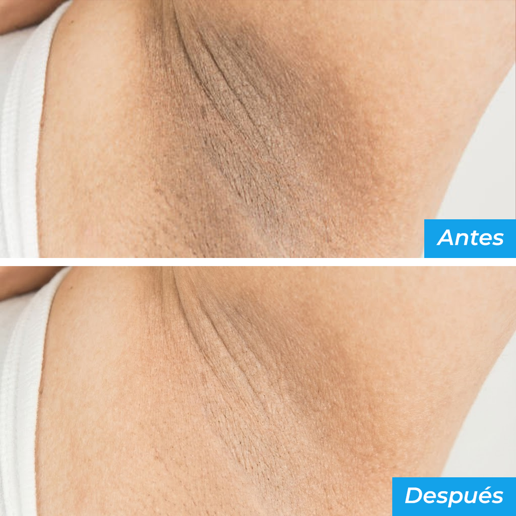 Desodorante Elimina Olores Spray